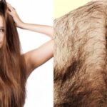 Почему волоски на теле человека не могут вырасти длиннее, нежели на голове