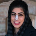 Почему у многих иранских девушек перебинтованы носы