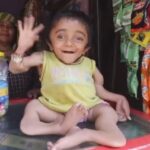 Редкая болезнь «выкрутила» кости индийского мальчика